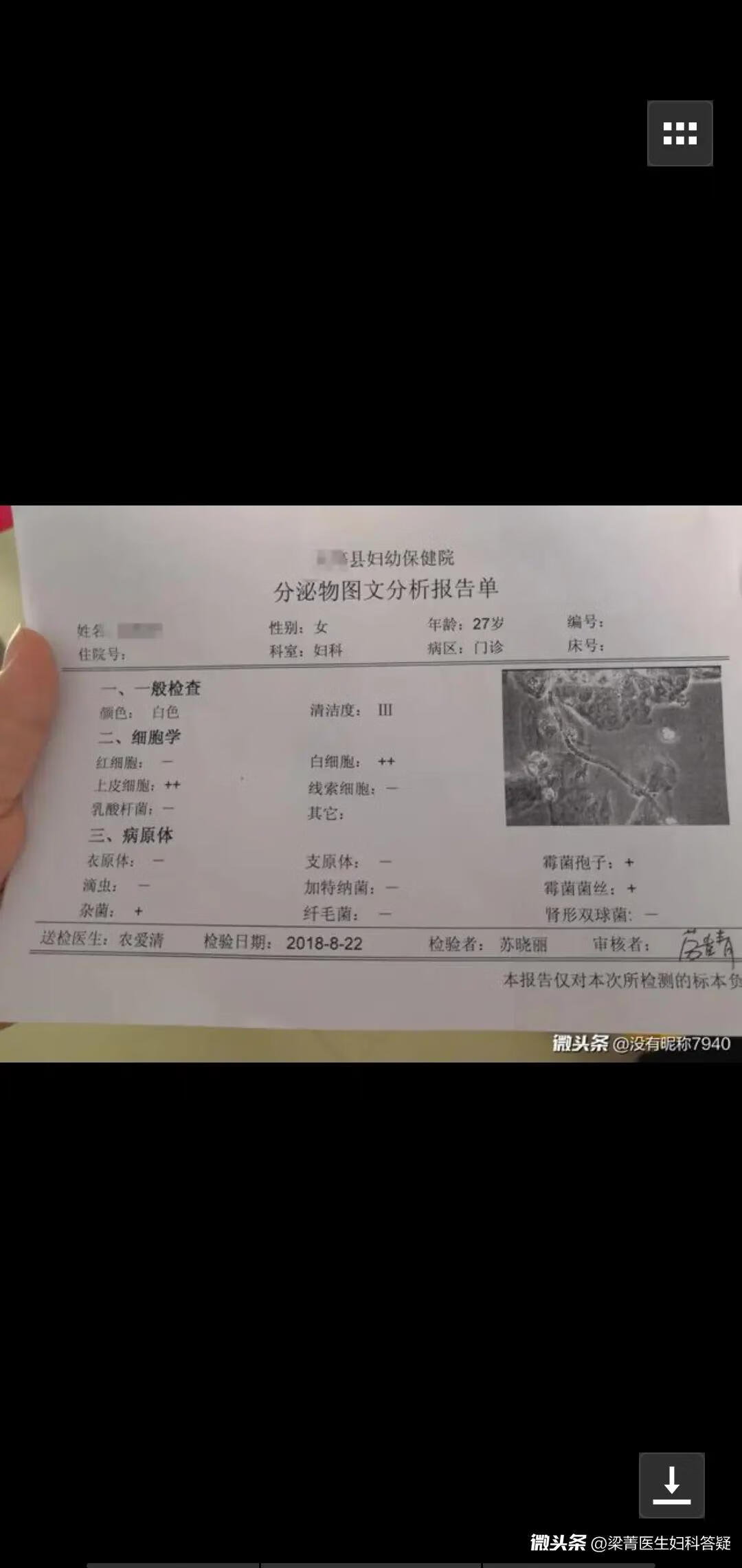 念珠菌感染用什么药好(念珠菌用什么药好)