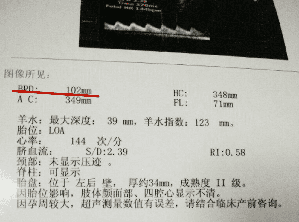 胎儿双顶径是什么意思(双顶径算男女的公式)