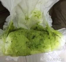 宝宝大便黑色颗粒(宝宝大便有点黑色)