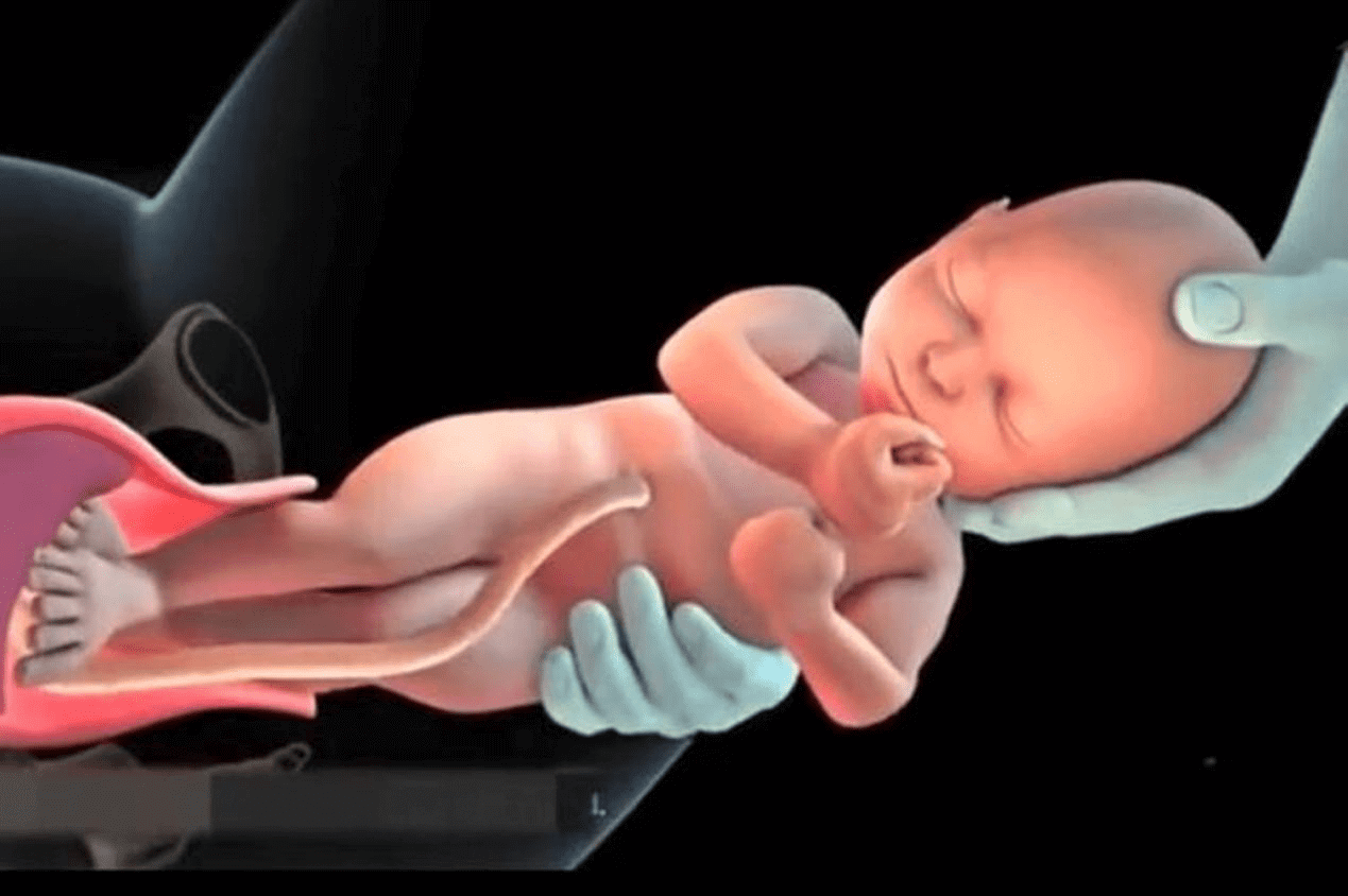 自然分娩的全过程(产妇顺产分娩全过程)