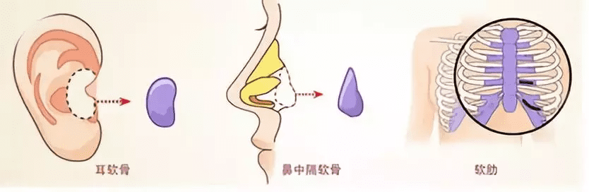 隆鼻精油吧(隆鼻精油真的有用吗)