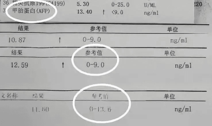 甲胎蛋白是什么意思(甲胎蛋白啥意思)