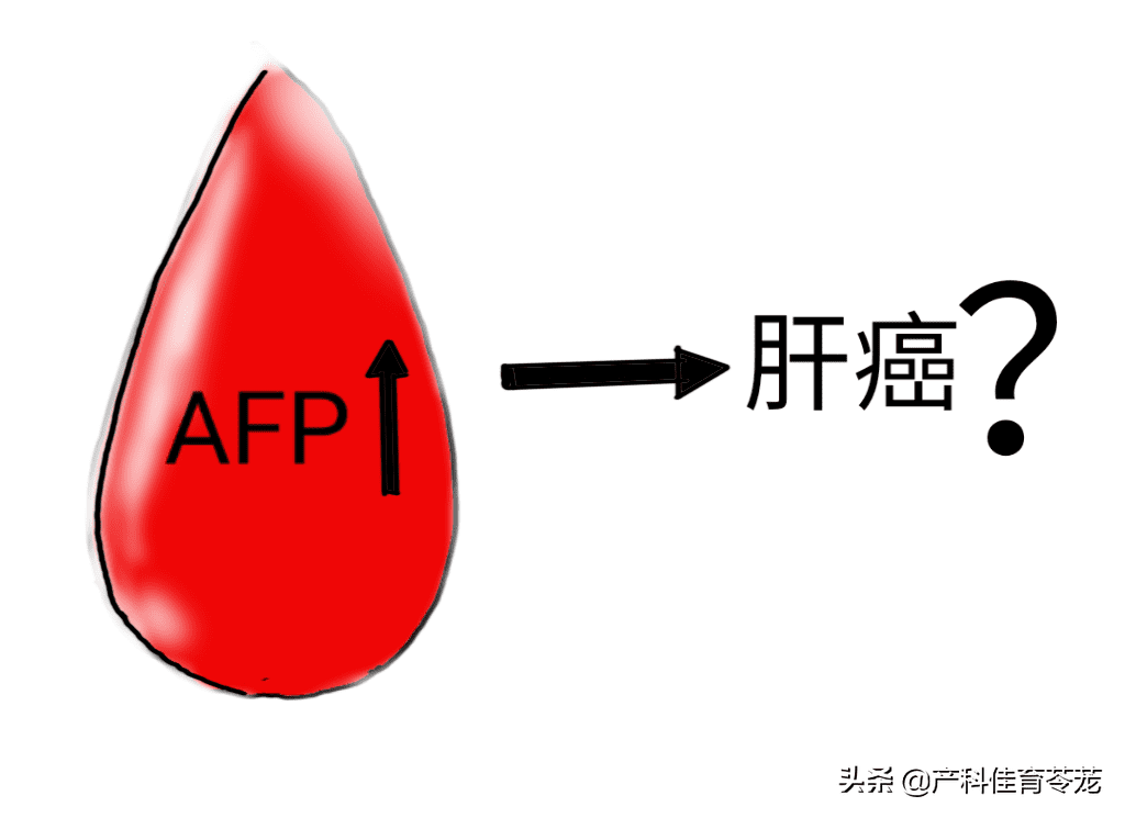 甲胎蛋白是检查什么的指标(甲胎蛋白怎么检查)