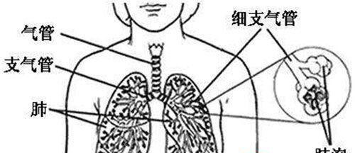 支气管肺炎(支气管肺炎必须要输液吗)