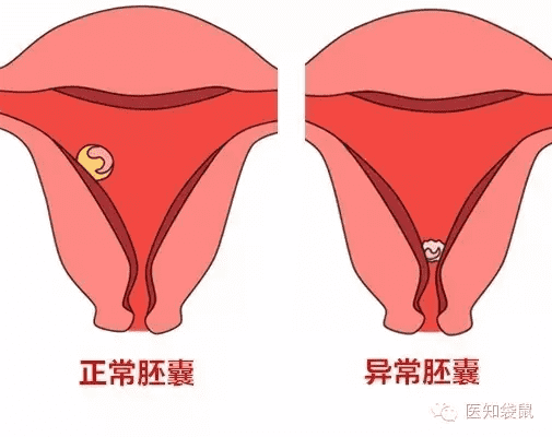 胎芽是什么部位(胎芽是什么样的图片)
