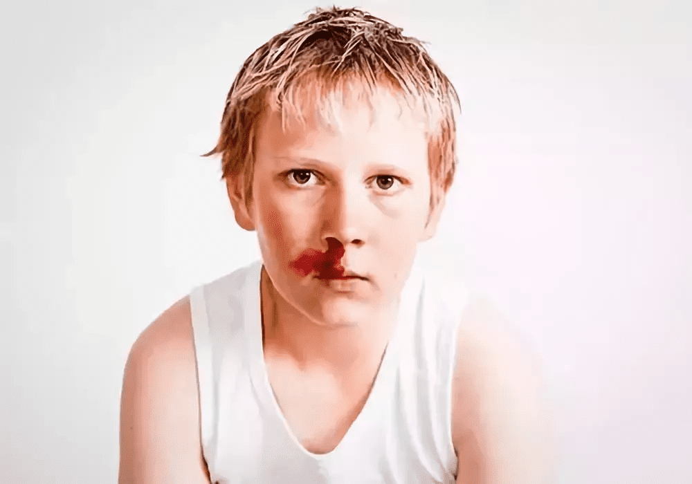 小孩流鼻血是什么原因引起的呢?经常(小孩子容易流鼻血是怎么回事)