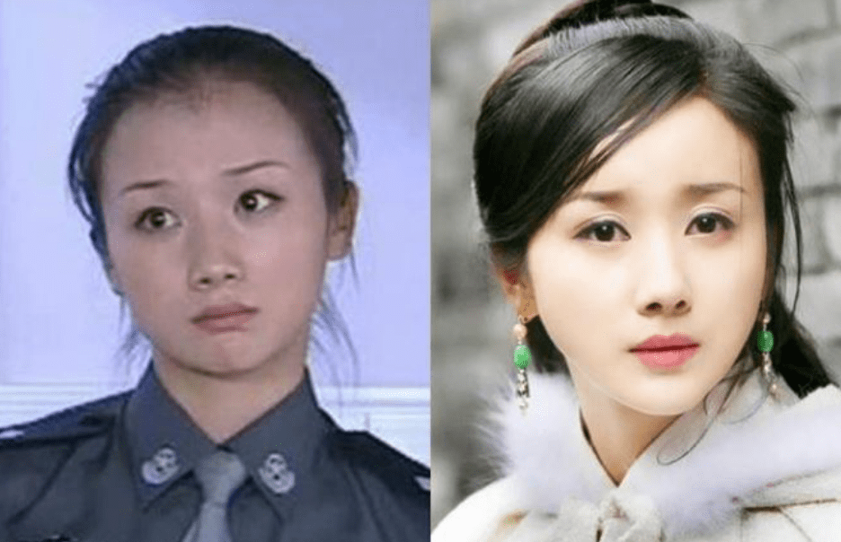 和张檬一样让人惋惜,因为整容整残的昔日玉女还有孙菲菲.