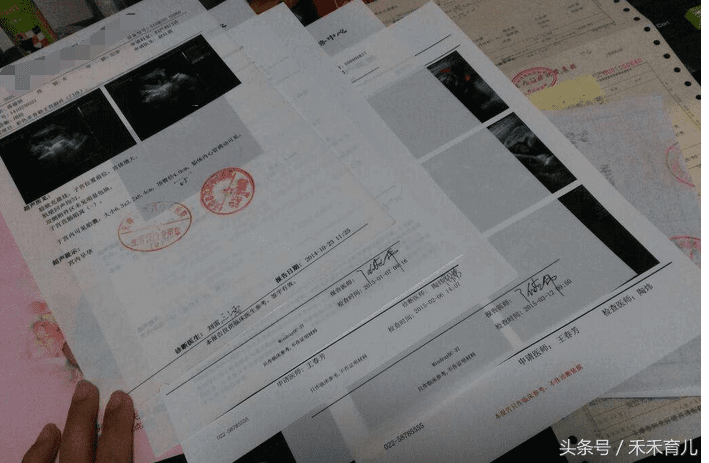 产检费用大概要多少钱(产检项目及其费用)