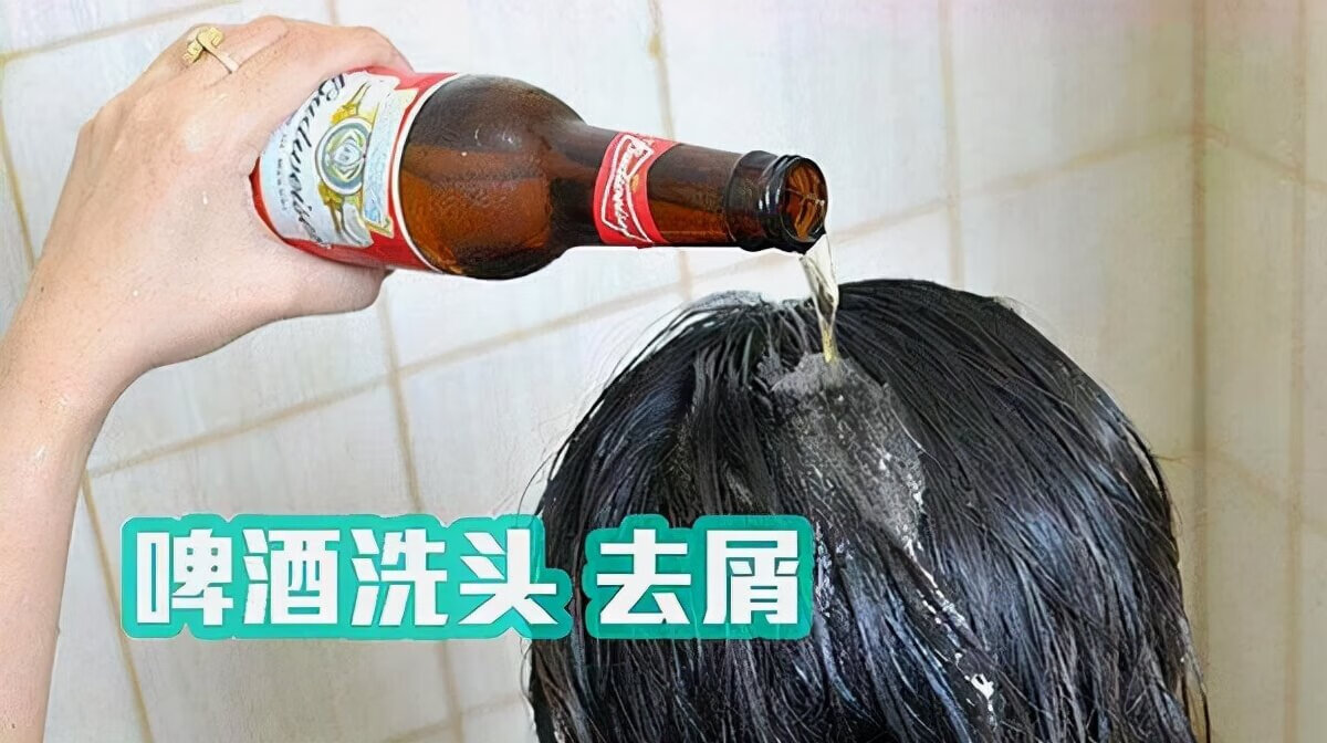 啤酒去头屑有效吗(啤酒去头屑最快最有效)