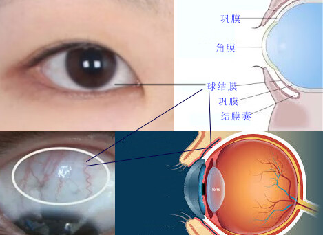 眼结膜位置图片图片