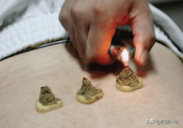 艾灸法包括哪些(自己艾灸方法图解大全)