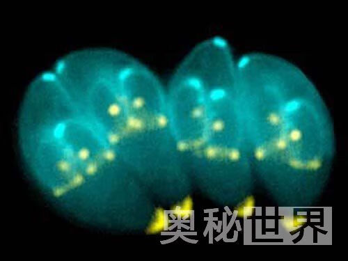 人体寄生虫有哪些(人体寄生虫图片)