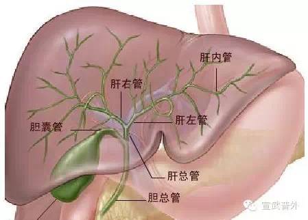 黄疸是什么意思啊(黄疸意味着什么)