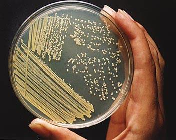 链球菌感染用什么药治疗(人感染链球菌用什么药最有效)
