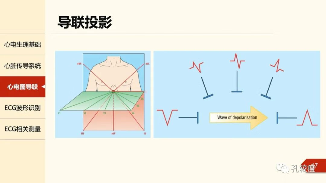 心电图导联位置示意图(心电图机导联位置图)