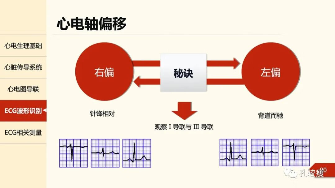 心电图导联位置示意图(心电图机导联位置图)