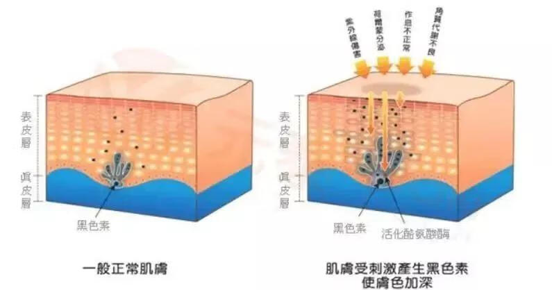 美容皮肤学(女生如何护肤)