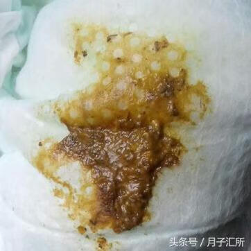 宝宝大便黑色颗粒(宝宝大便有点黑色)