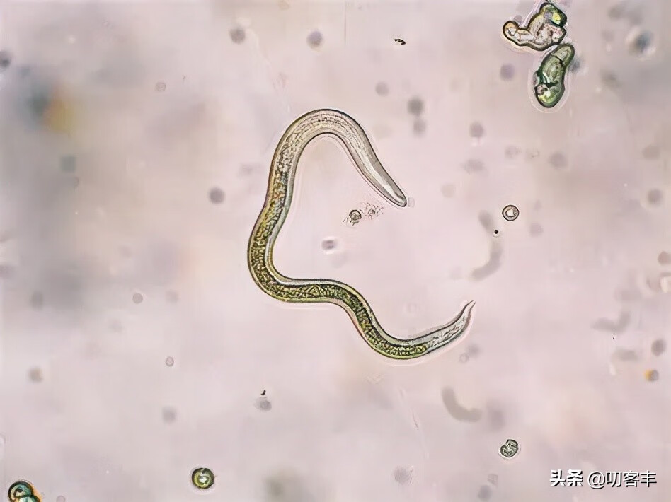 有蛔虫的症状是怎样子的(大人有蛔虫最明显的症状是什么)