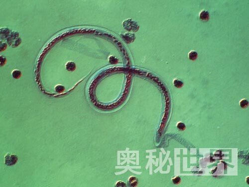 人体寄生虫有哪些(人体寄生虫图片)