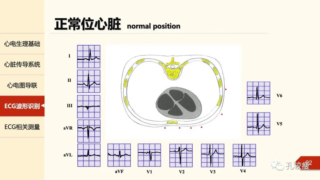 心电图导联位置示意图(心电图机导联位置图)