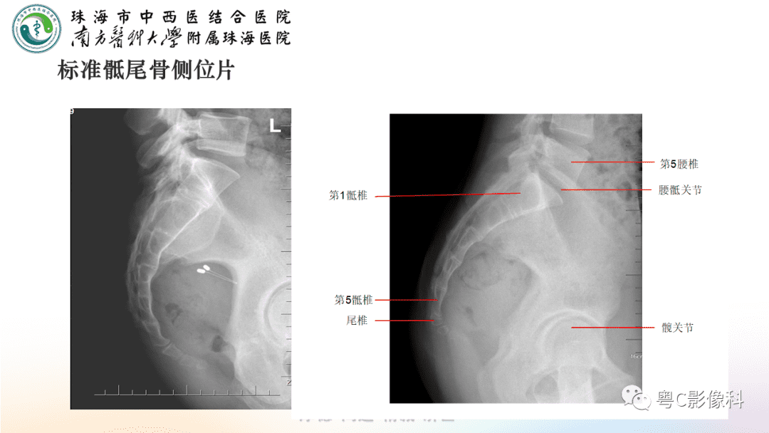 后侧位体视频(后侧体位展示)