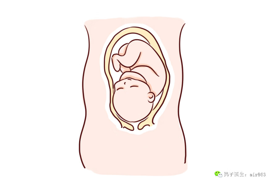 胎位异常多见于(临床上最常见的异常胎位是)