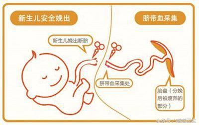 脐带血保存是骗局吗(脐带血到底要不要存)