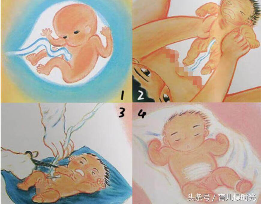 小儿腹泻贴贴哪里(小儿腹泻贴有用吗)