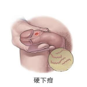 性疾病有哪几种都有哪些明显症状(男性得了性疾病有什么症状图片)
