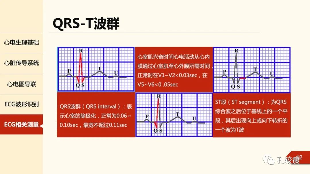 心电图导联位置示意图(心电图机导联位置图)