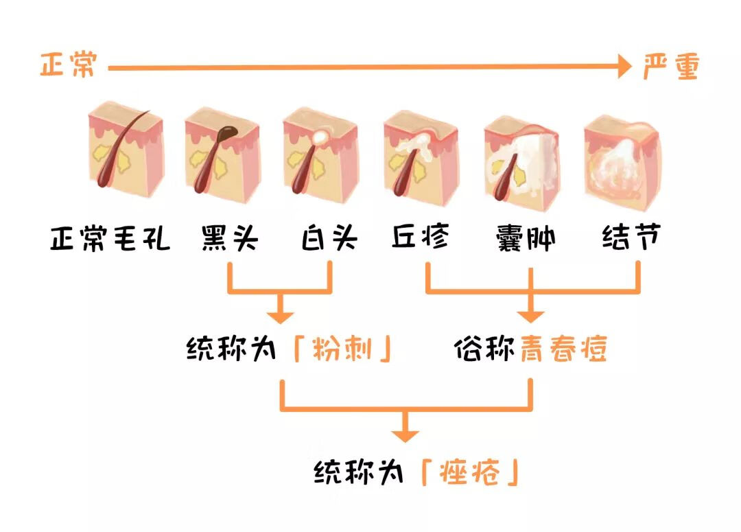 去黑头的最佳方法(去黑头的有效方法)