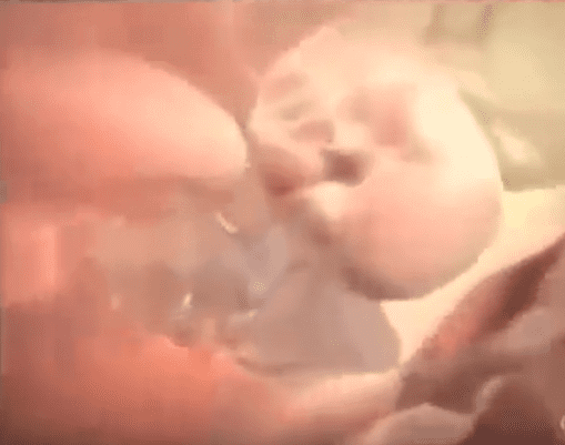 孕妇自然分娩全过程组图(孕妇产孩子全过程图片)