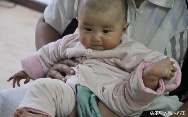 6个月宝宝拉肚子怎么回事(6个月宝宝突然拉肚子是怎么回事)