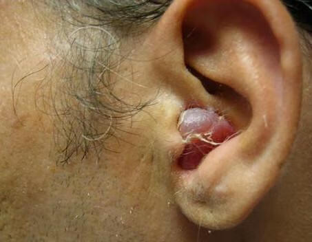 耳朵聋耳鸣是什么原因引起的(耳鸣耳聋是什么原因造成的)-百科学社