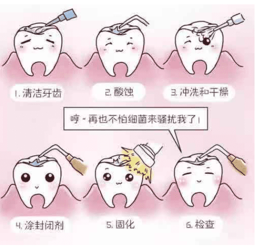 窝沟封闭能预防龋齿吗?