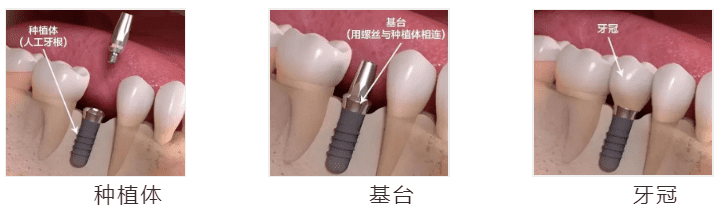 口腔检查报告(口腔医院)