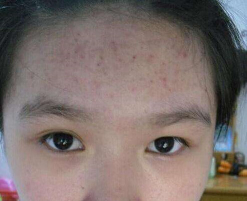 身上来月经前有什么症状(来月经的症状有哪些)
