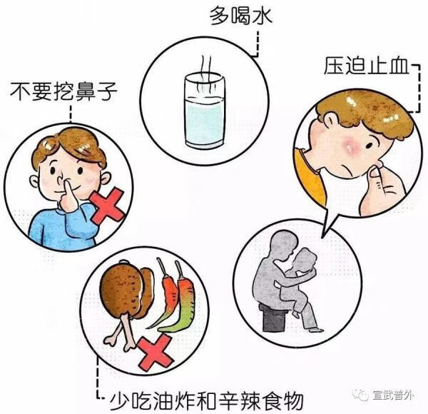 鼻子流血怎么办(鼻子一直有血是怎么回事)