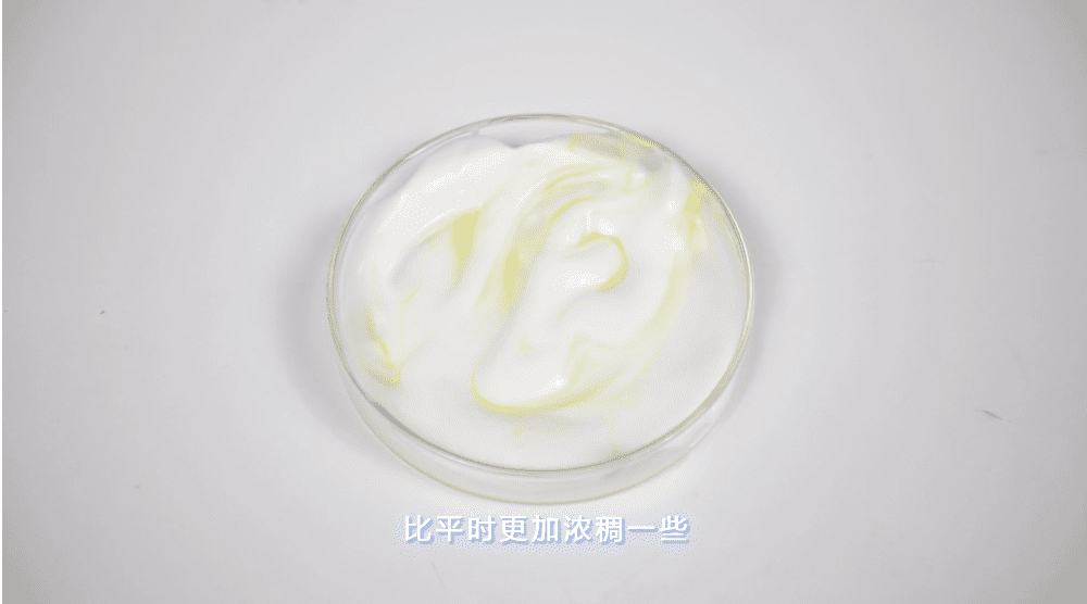 白带(白色豆腐渣分泌物照片)