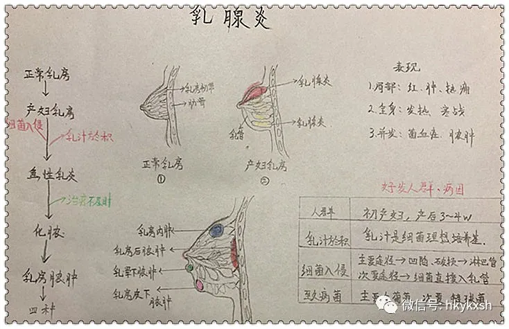 急性乳腺炎怎么办(乳腺炎怎么调理最好方法)