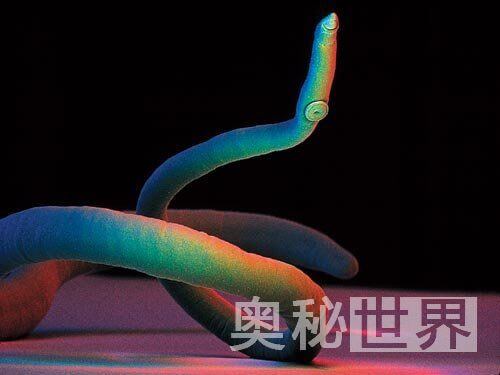 人体寄生虫有哪些(人体寄生虫图片)