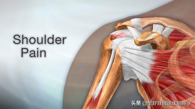 左肩膀疼痛是什么原因引起的(左肩胛骨疼痛是什么原因)