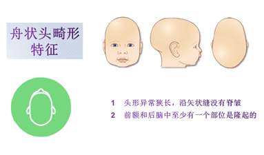 畸形婴儿图片(畸形图片)