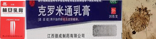 治疗疥疮最有效的药物(治疗疥疮的药物有哪些)