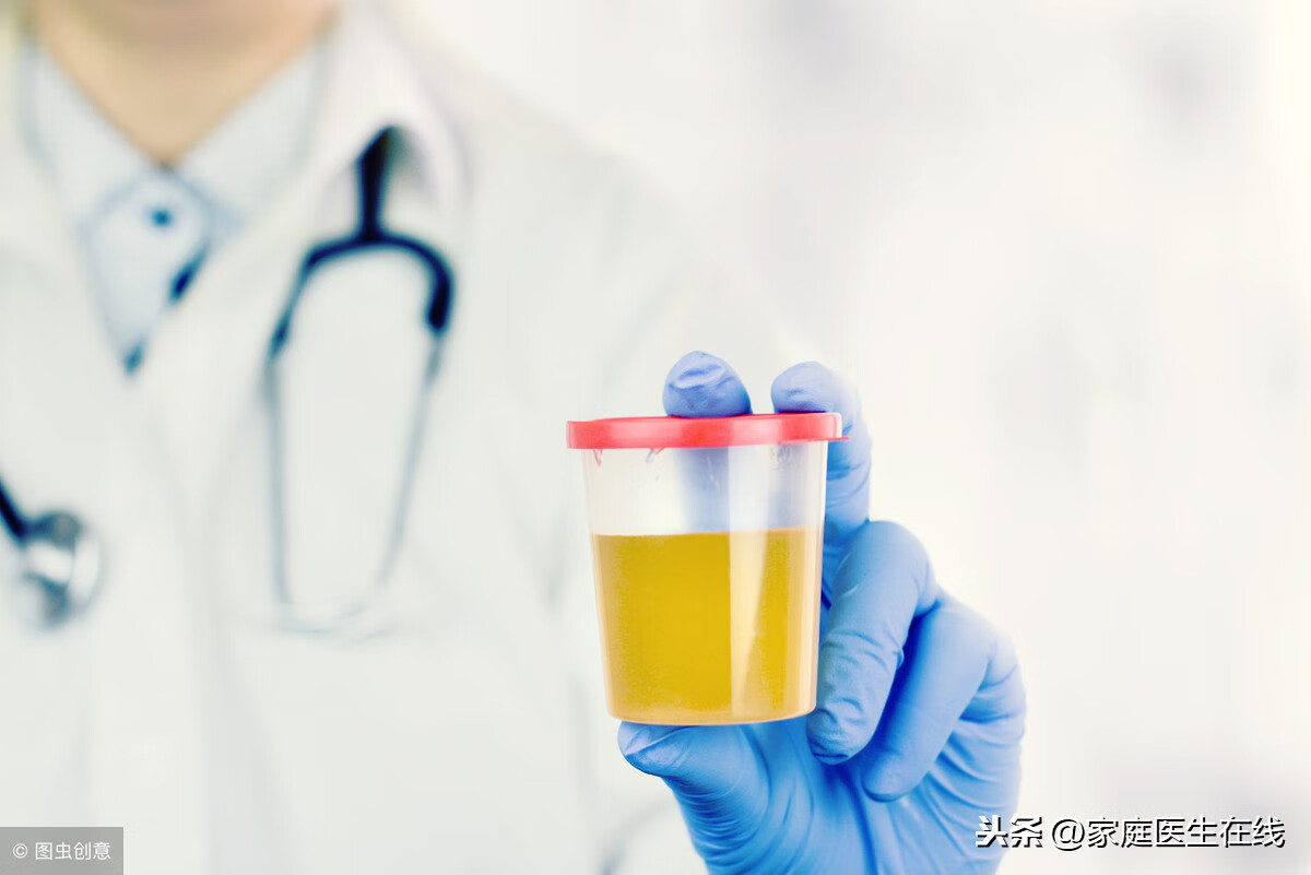 尿检白细胞高说明什么问题(尿常规检查结果白细胞高)