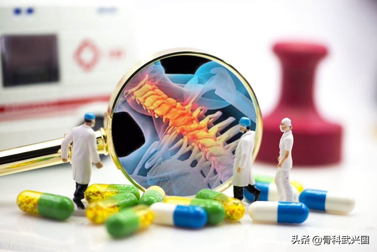 骨刺的症状是什么样的(骨刺是什么症状图片)