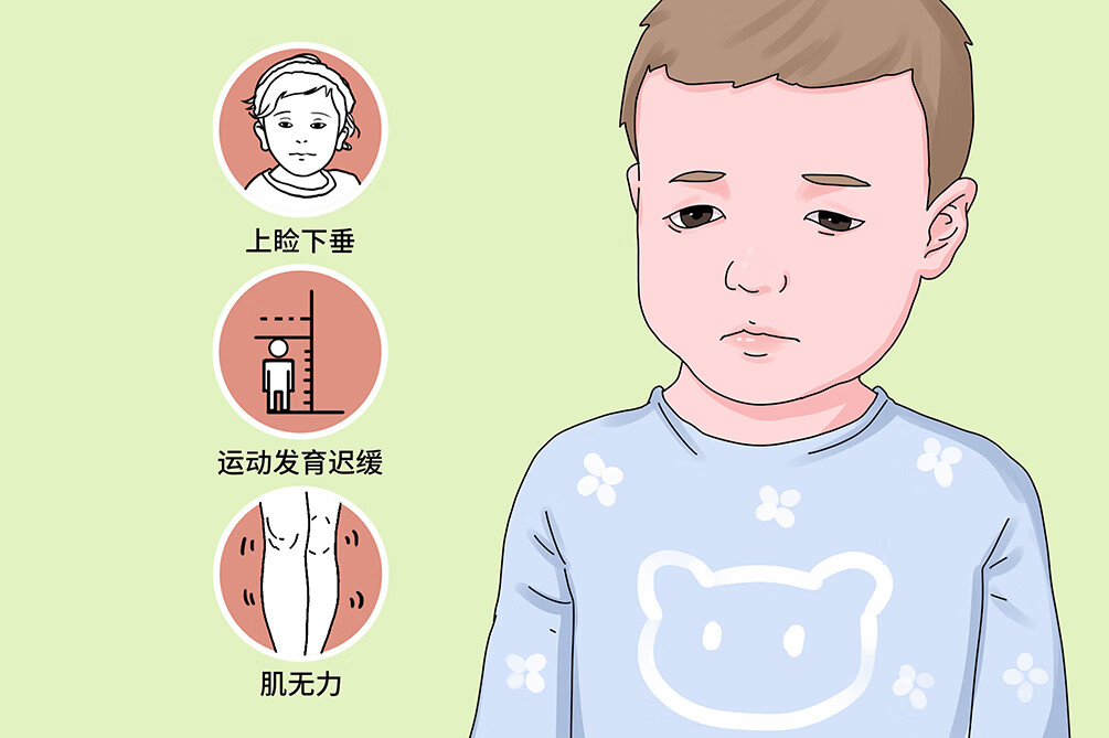 多系统萎缩症是什么病(多系统萎缩的病因)