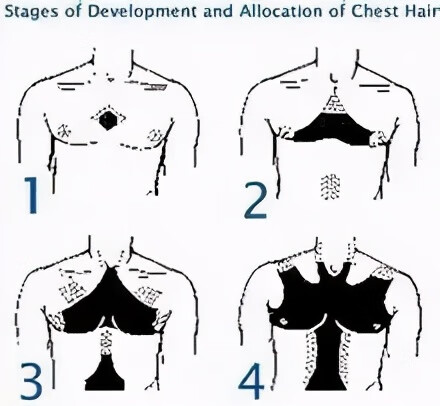 乳晕发黑是怎么回事?(怀孕胸变黑能恢复吗)