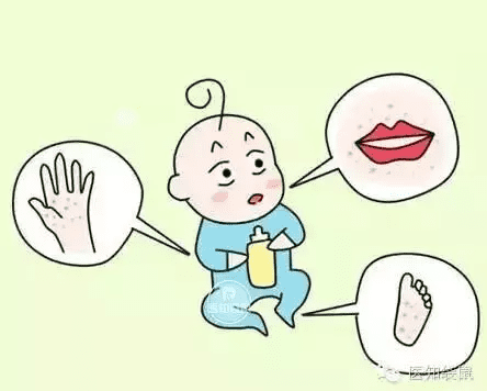 小孩手足口病症状初期(小儿手足口病的症状图片)